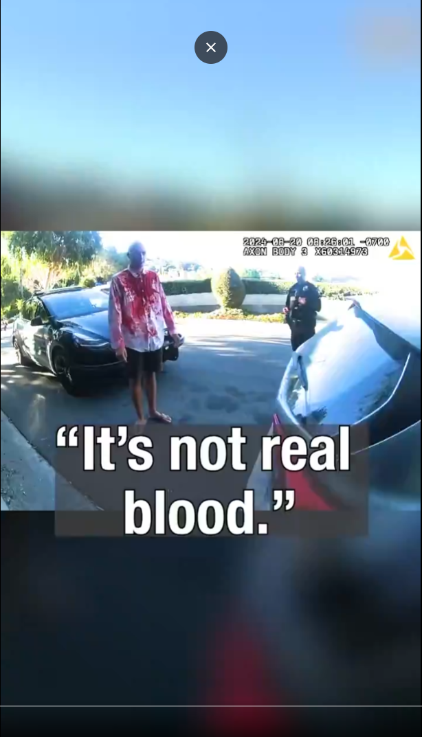 โItโs not real bloodโฆโ but everyoneโs heart stopped for a second ๐ฉธ๐