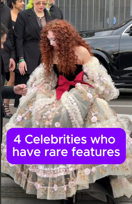 4 Celebrities With Rare and Remarkable Features